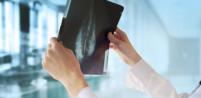 Doctor con la mamografía