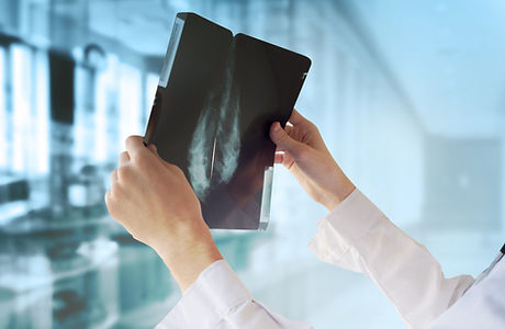 Doctor with Mammography