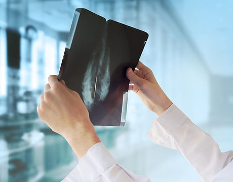Doctor with Mammography
