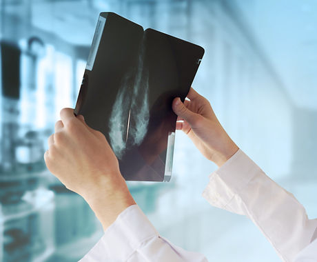 Doctor with Mammography