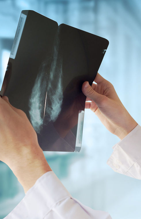 Doctor with Mammography