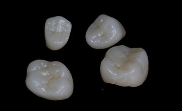 CORONAS MONOLITICAS DE ZIRCONIA MAQUILLADAS .jpg
