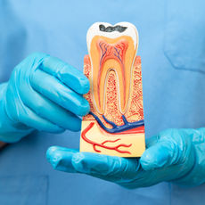 How Much Do Dental Implants Cost in Upland, CA?