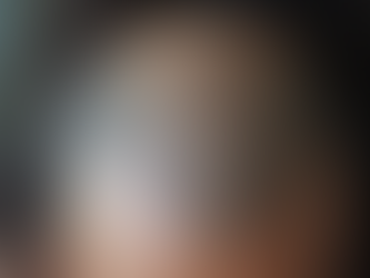 Understanding Autoimmune Diseases and Their Impact on Hair Health