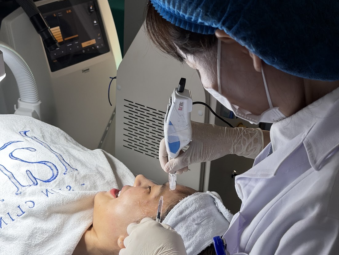 Bác sĩ sử dụng phi kim để điều trị mụn sẹo