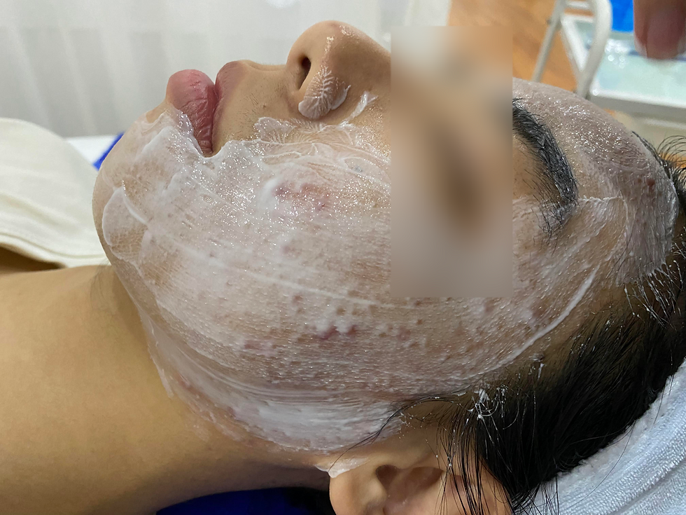 Dưỡng ẩm và làm sạch nhẹ nhàng - phục hồi viêm da cơ địa