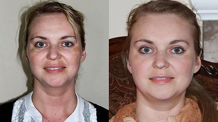 Before and After Full Face.jpg