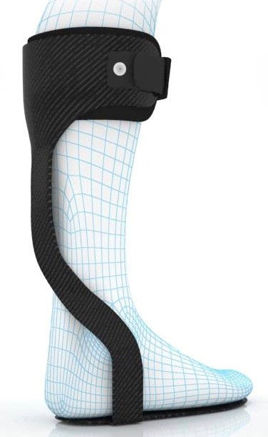 Foot drop treatment