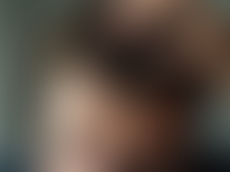 Understanding Dandruff: Causes and Treatments Explained