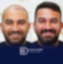 Kök Hücre Destekli Saç Ekimi