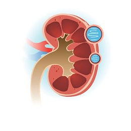 Dawa ya kutibu ugonjwa wa figo