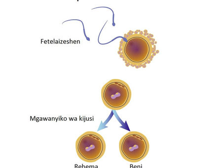 Pata ujauzito wa mapacha| ULY CLINIC