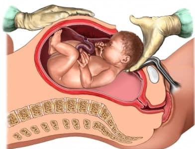 Njia za kujifungua mtoto