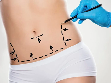 When Is the Right Time for Plastic Surgery?