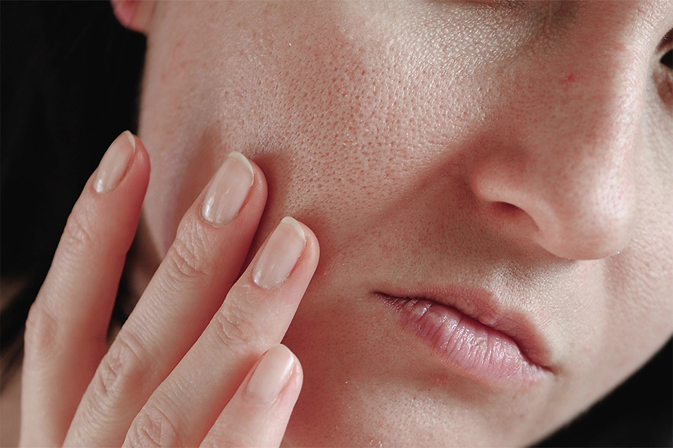 Large Pores Treatment Cost in Dubai
