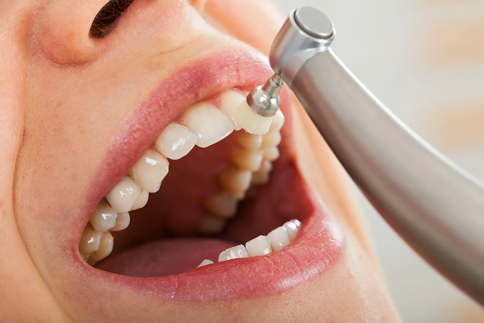Teeth Cleaning Cost In Dubai
