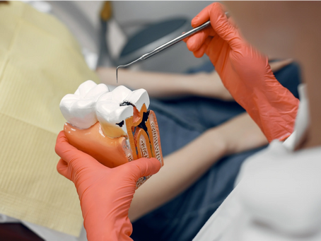 Does Insurance Cover Root Canal Treatment in Dubai?