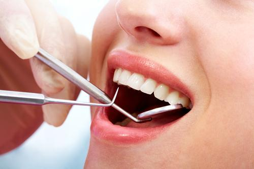 Teeth Cleaning Cost In Dubai