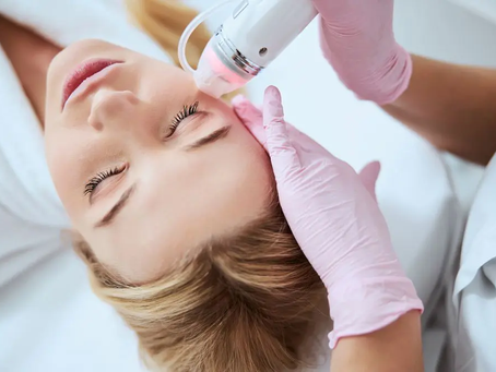 How Plasma Pen Treatment Works for Stretch Marks