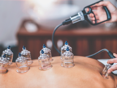 What Happens During Hijama Cupping Therapy