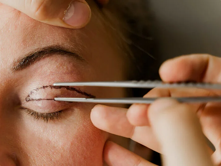 Who Needs Eyelid Surgery Price Details?