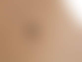How to Avoid Complications in Skin Tag Removal in Dubai