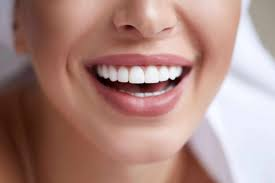 Understanding Teeth Whitening Cost in Dubai for Modern Smiles