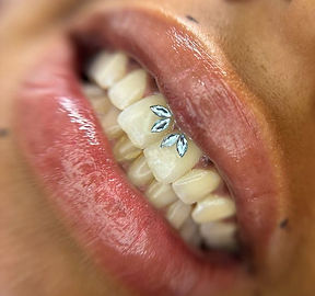 Sourire avec strass dentaire