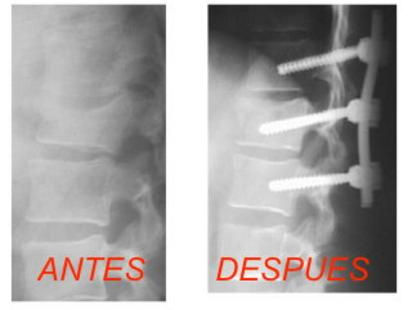 Dr.Bernardo Herrera Juarez, Columna, Traumatologo, Oaxaca