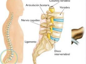 Dr.Bernardo Herrera Juarez, Columna, Traumatologo, Oaxaca