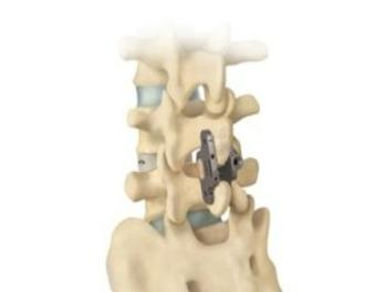Dr.Bernardo Herrera Juarez, Columna, Traumatologo, Oaxaca