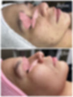 BEFORE AND AFTER