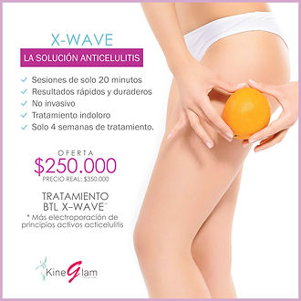 SOLUCIÓN ANTICELULITIS CON X-WAVE: OFERTA DE $250.000 (4 semanas de tratamiento)