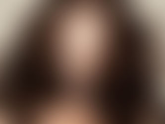 Alopecias: Queda de Cabelo Não É Tudo Igual!