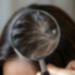 man-with-hair-loss-problem-before-after-treatment-hair-losing-man-hair-loss-treatment-back