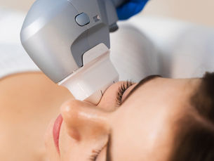 Rejuvenescimento facial e melhora da textura: o poder da combinação entre Liftera e laser para qualidade da pele