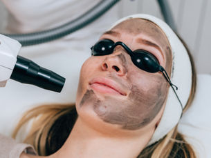 Glow Peel: O Peeling a Laser Que Ilumina e Renova Sua Pele