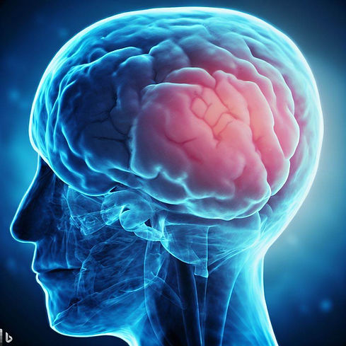 brain cancer, GBM.jpeg