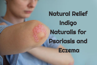 Psoriasis treatment using Indigo Naturalis