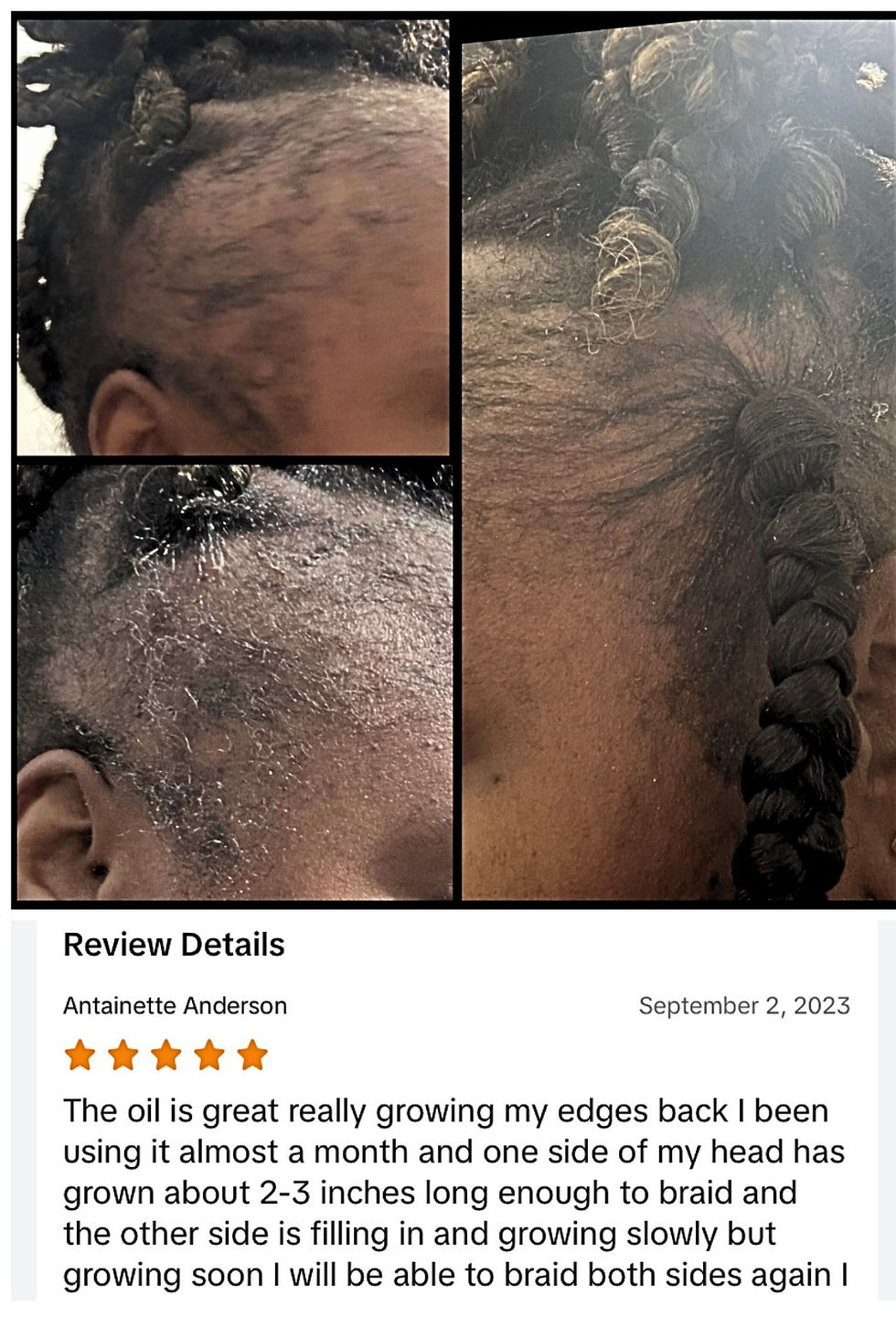 EDGES REGORWTH