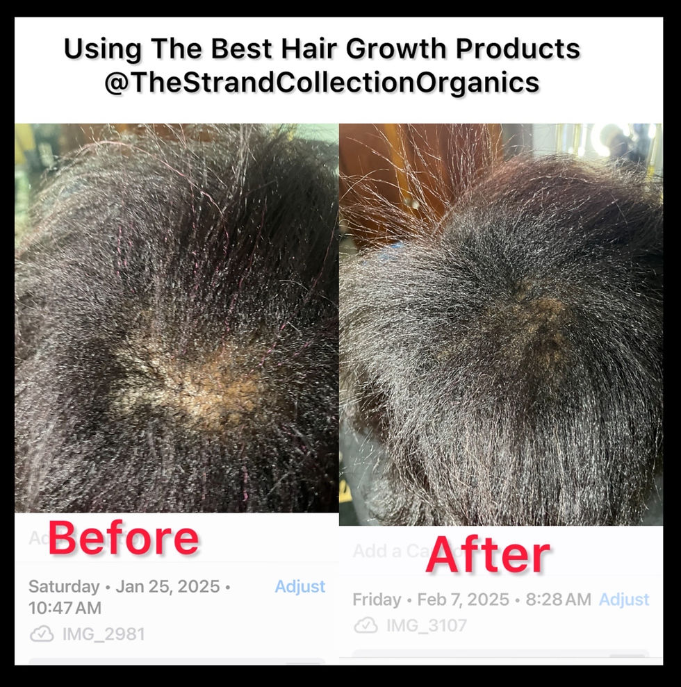 bald spot regrowth by the strand collection