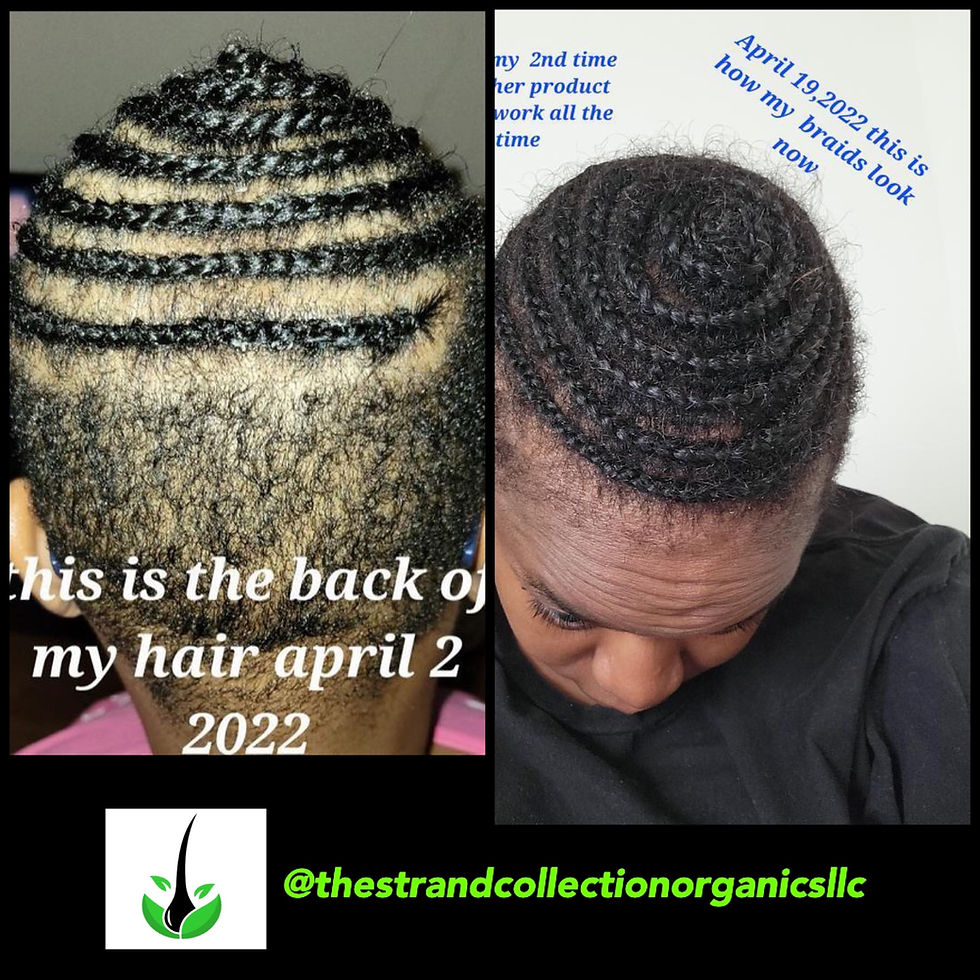 HAIR GROWTH