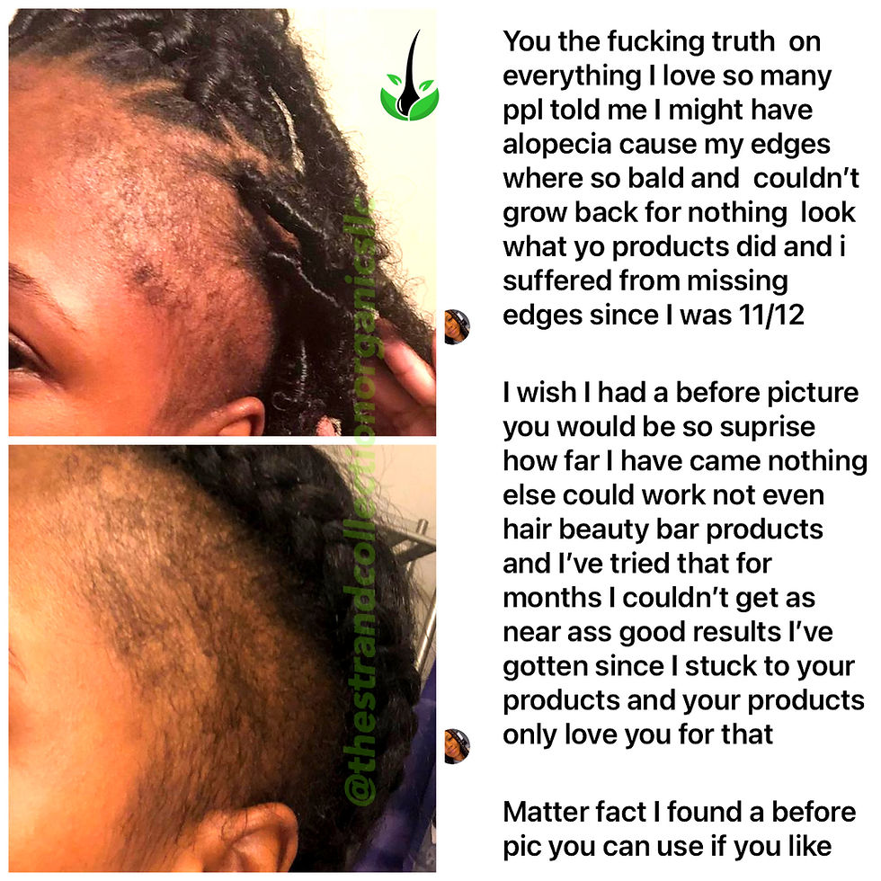 EDGES REGROWTH