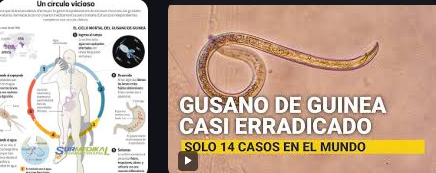 Ciclo de la enfermedad Gusano de Guinea