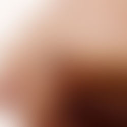 The Intersection of Biotechnology and Implantable Devices