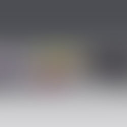 3D Printing in Medicine: Breakthroughs in Prosthetics and Organ Models