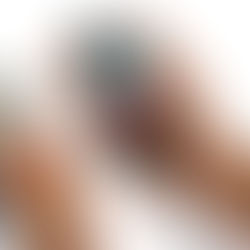 5 Key ISO Standards Every Medical Device Developer Must Know