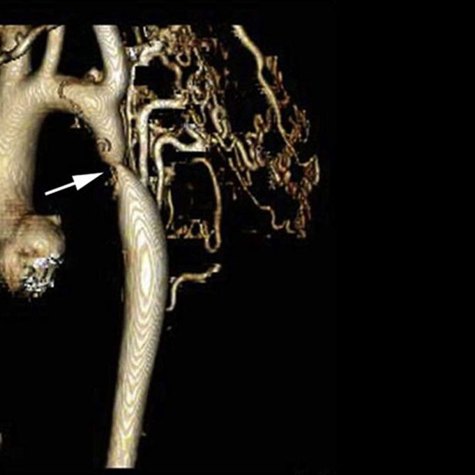 Essential Calculations for Optimal Fluid Flow Design