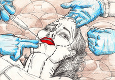 Plastic Surgery