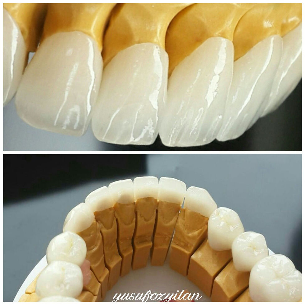 Ethetic Teeth